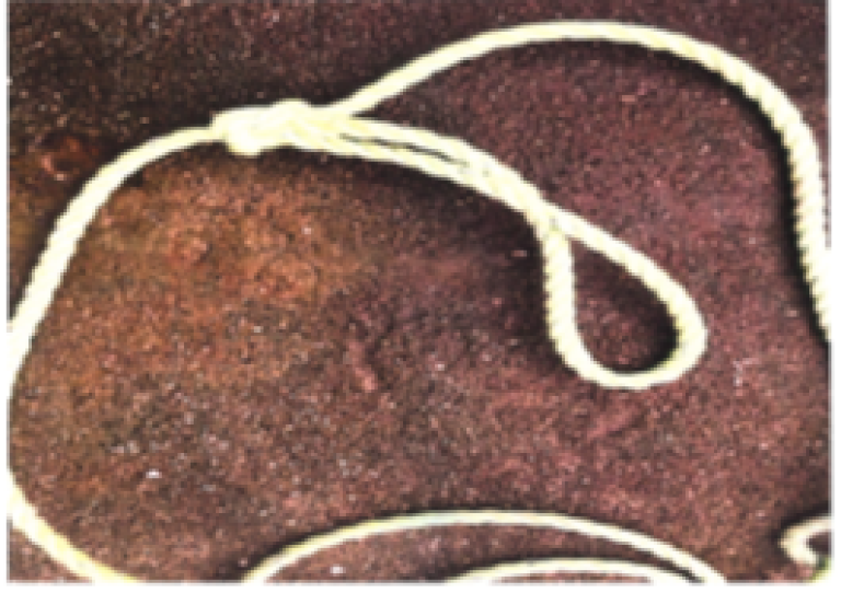 Figur 2:Knuten som hadde oppstått på opphalertauet. Foto: © Selskapet Figur 2:Knuten som hadde oppstått på opphalertauet. Foto: © Selskapet